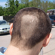 Illustration for article titled Ferrari Head Shave Gallery